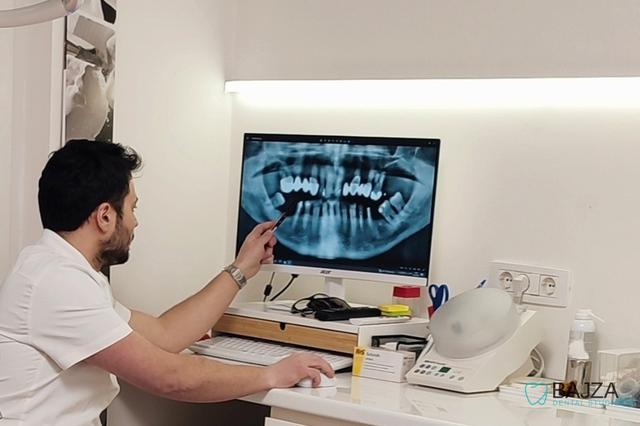 Doktor bajza gleda brzi digitalni rentgen ortopan snimak na ekranu