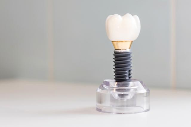 Vidi se model titanskog zubnog implantata Straumann s garancijom kvalitete